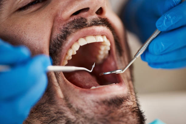 Best Cracked Tooth Emergency Dentist  in Dry Run, OH